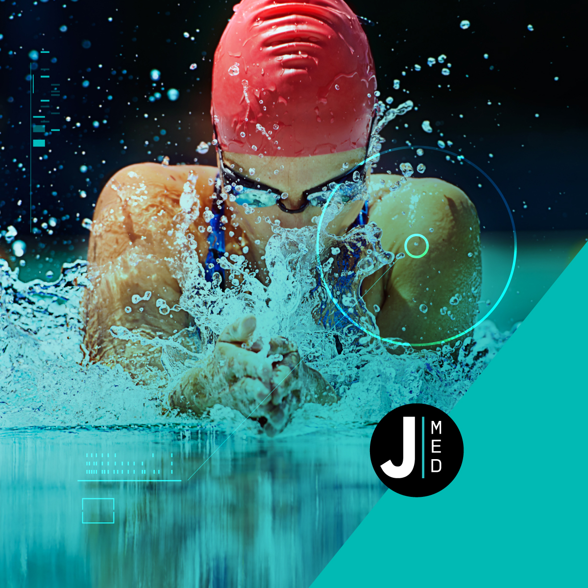 Come prevenire gli infortuni nel nuoto?